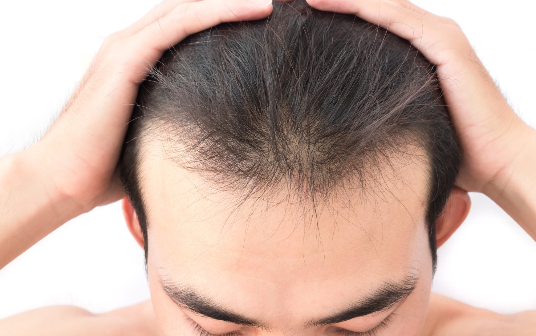 Best trattamenti per combattere la caduta e il diradamento dei capelli