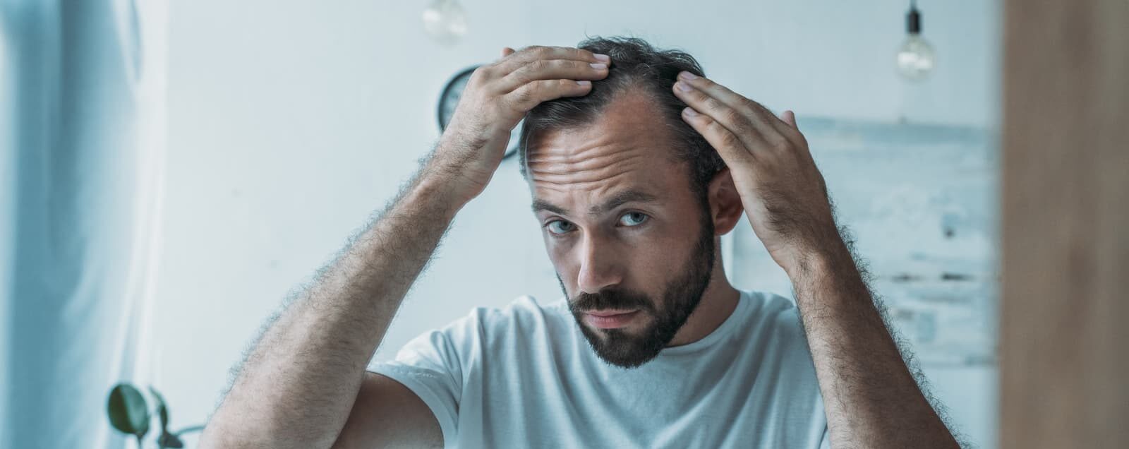 Non ignorate questi segnali: potreste soffrire di alopecia