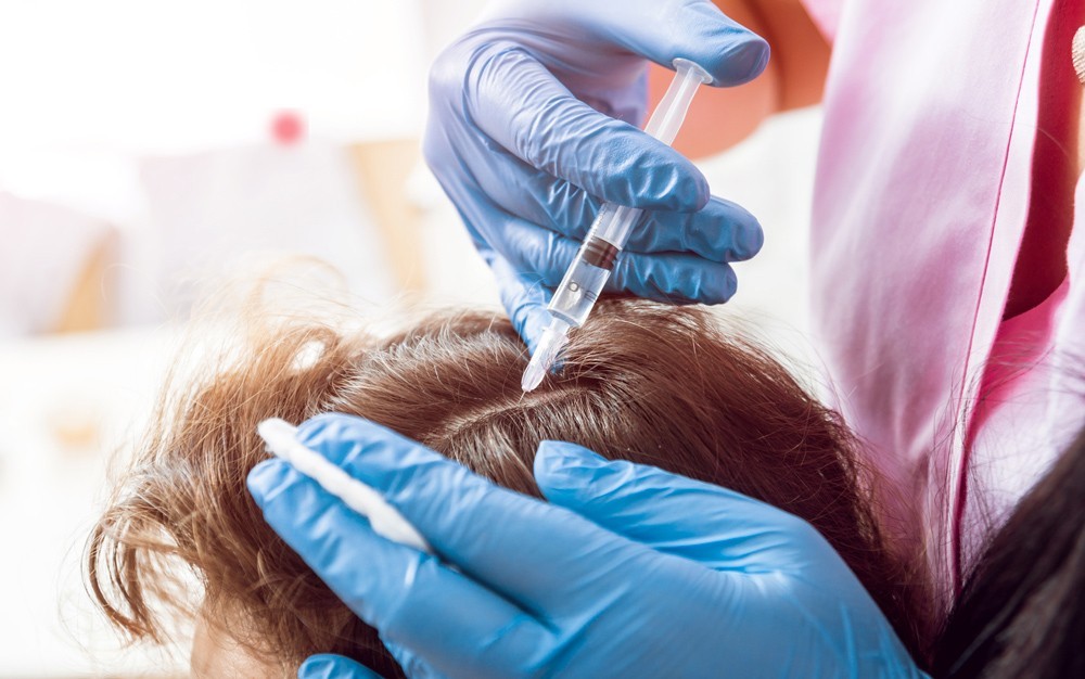 Capillary Mesotherapy for Regeneration of Hair